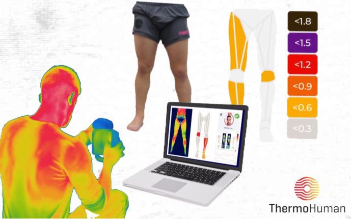 ΘΕΡΜΟΓΡΑΦIΑ